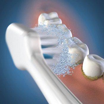 Pontas/Recargas Escova Elétrica Triple Sonic Waterpik