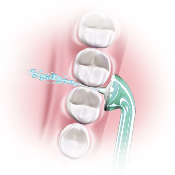 Philips Sonicare AirFloss Recarga Verde Philips Sonicare AirFloss Recarga Verde