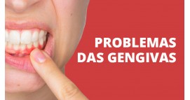 Problemas das gengivas