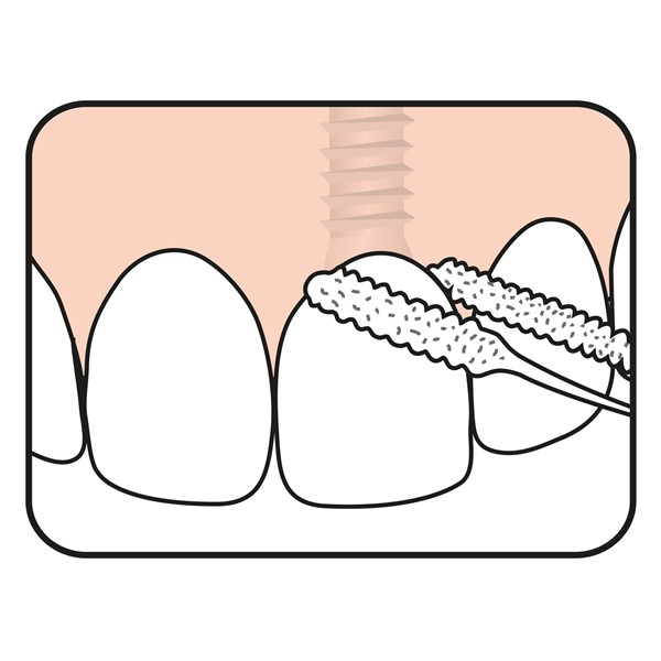 Fio dentário Pontes & Implantes TePe Fio dentário Pontes & Implantes TePe