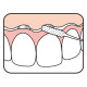 Fio dentário Pontes & Implantes TePe Fio dentário Pontes & Implantes TePe
